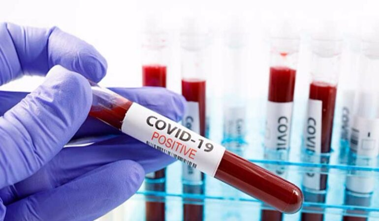 Covid-19 hastalarına pozitif bileklik ve kutu uygulaması geliyor