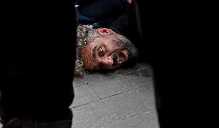 Gazetecilere polis şiddetine uluslarası tepki